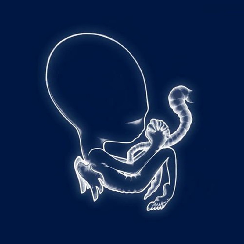 Sigur Ros — Aegetis byrjun vinilo
